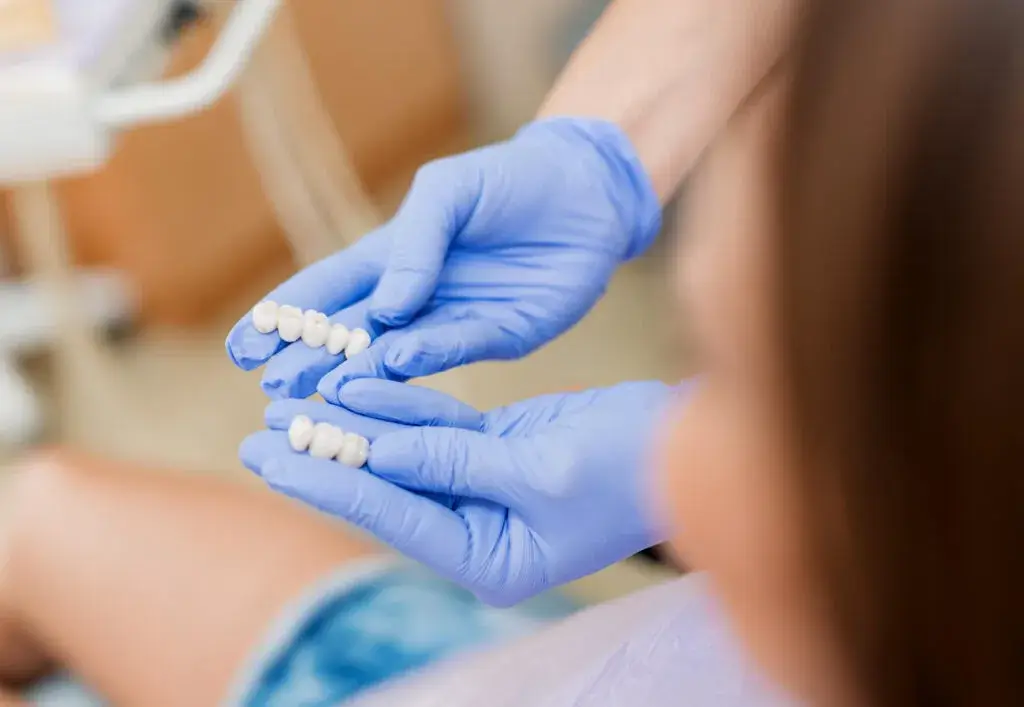 Dental Crown Procedure - Auburn Dentist