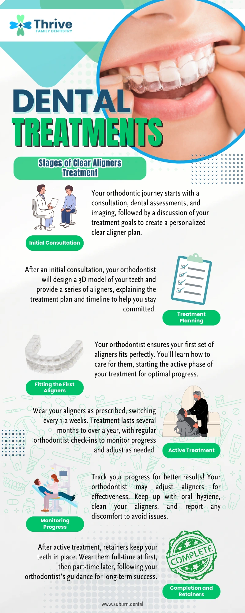 Stages of Clear Aligners Treatment